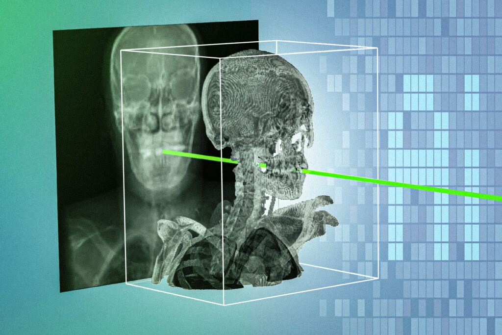 New AI technique could make minimally invasive surgeries safer and more precise | MIT News